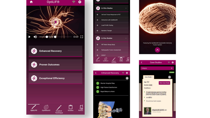 OptiMesh App for Spineology