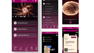Spineology OptiLIF screenshot
