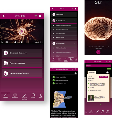 Spineology OptiLIF screenshot
