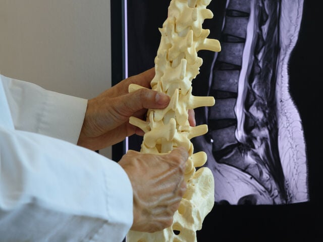 Spine Model